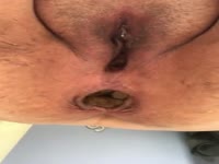 Scat shit defecation 5
